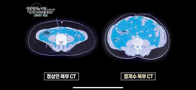 KBS1 ‘생로병사의 비밀’ 976회