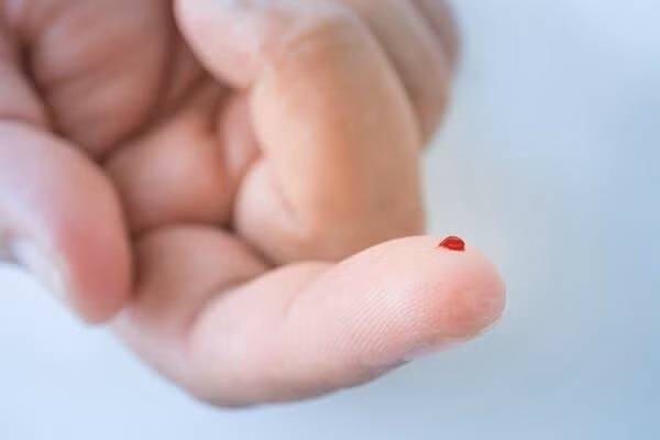 13개국 31개 연구기관과 대학으로 구성된 국제 공동 연구팀이 손가락 끝에서 채취한 피 한 방울만으로도 정확하게 알츠하이머를 진단할 수 있는 방법을 개발해 주목받고 있다.  미국 텍사스 오스틴대 의대 제공