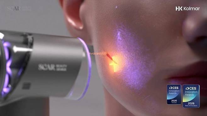 This rendering shows Kolmar Korea’s Scar Beauty Device applying makeup powder directly onto a scar immediately after treatment. The technology received the best of innovation award at CES 2026. (Kolmar Korea)