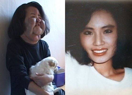 ‘선풍기 아줌마’로 알려진 고(故) 한혜경씨가 불법 성형을 받기 전 모습. SBS ‘꼬리에 꼬리를 무는 그날 이야기’