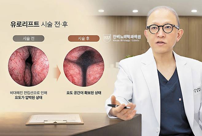 윤철용 대표원장이 유로리프트 시술에 대해 설명하고 있다. 윤 원장은 “전립선비대증은 진단부터 시술, 이후 경과 관리까지 한 의료진이 환자와 끝까지 동행하는 책임 진료가 중요하다”고 말했다. /그래픽=김민선 김지아 헬스조선 객원기자