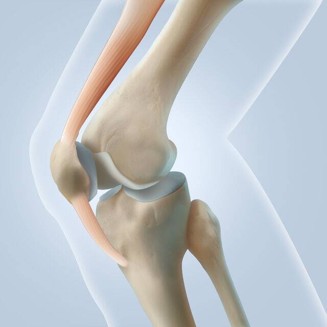 슬개골 연골연화증은 슬개골과 대퇴골 사이 연골이 약해지거나 손상되며 통증이 발생하는 질환이다. 클립아트코리아