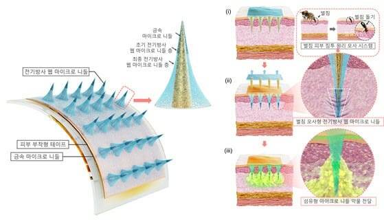 전기방사 웹 마이크로 니들 구성 및 벌침 모사형 피부 삽입 방법, 서방형 약물 전달 과정을 설명한 개요도.(그림=KIMM)