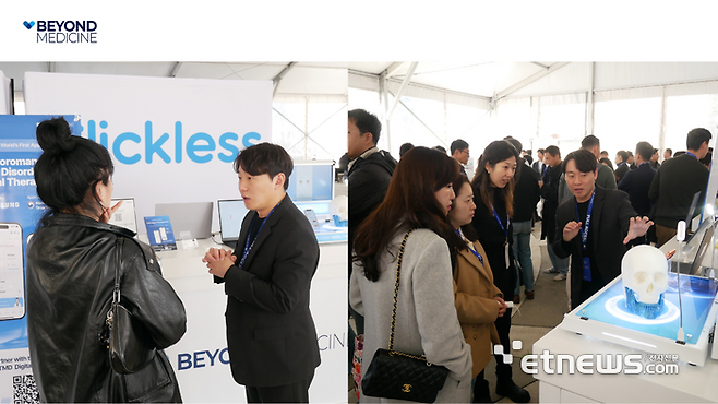 비욘드메디슨은 美 실리콘밸리 UKF에서 턱관절 장애 디지털 치료제 클릭리스를 시연했다.