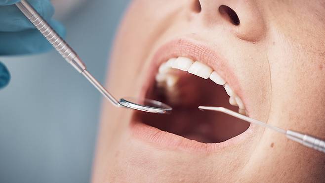 치과 치료의 기본 원칙은 가능한 한 자연치아를 보존하는 데 있다|출처: 게티이미지뱅크