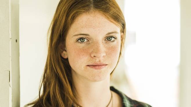 자외선이 비교적 적은 겨울철이 흑자 제거하기에 좋은 시기다｜출처: 클립아트코리아