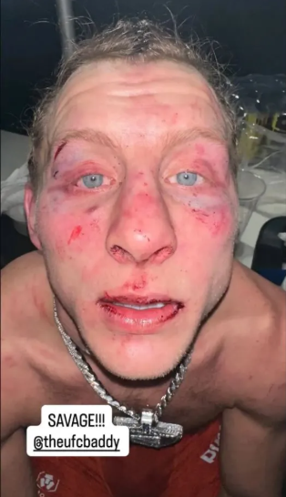 패디 핌블렛. 사진=데이나 화이트 SNS