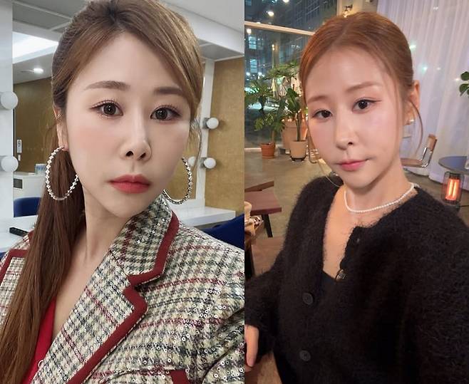 개그우먼 박세미가 코 재수술을 받았다고 밝혔다. /사진=박세미 인스타그램