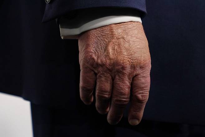 도널드 트럼프 대통령이 현지시간 29일워싱턴 '케네디-트럼프 센터'에서 열린 영화 '멜라니아'의 시사회에 참석한 자리에서 촬영된 오른손. AP=연합뉴스