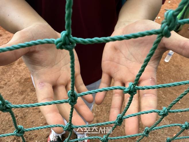 김건희의 손바닥. 양손 검지 끝자락에 모두 까졌을 정도로 열심히 훈련 중이다. 가오슝 | 박연준 기자 duswns0628@sportsseoul.com