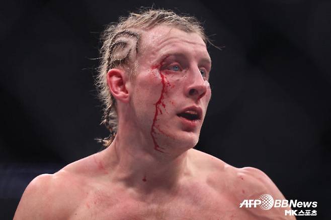 패디 핌블렛. 사진=AFPBBNews=News1