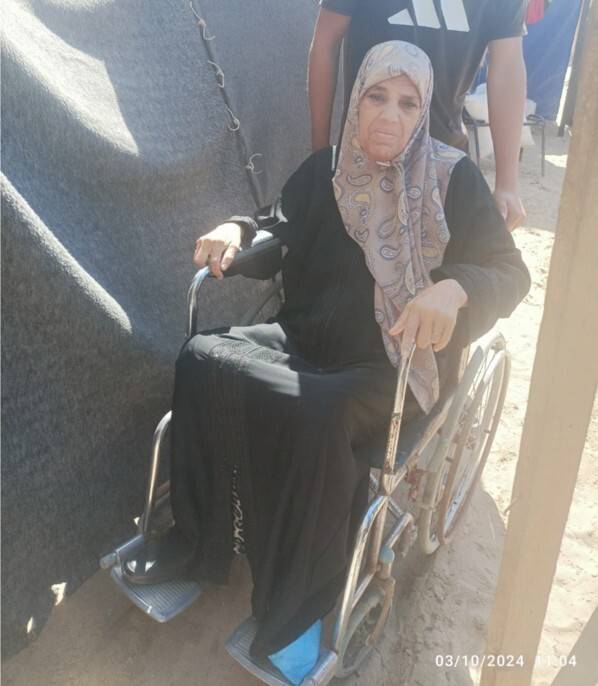 발 일부를 절단하는 수술을 받은 뒤 휠체어를 탄 하나아 하와. 이슬람 하와 제공