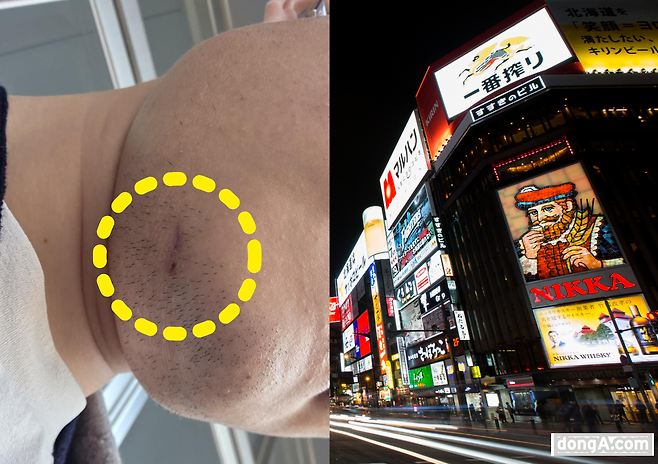 통역 지원과 관련해 외교부는 “지인을 통해 의사소통이 가능했다”고 설명했으나, 피해자 측은 지원이 이뤄지지 않았다고 주장하고 있다. 사진= 독자 제공, 게티이미지뱅크.