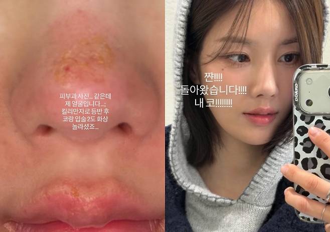 /사진=권은비 SNS