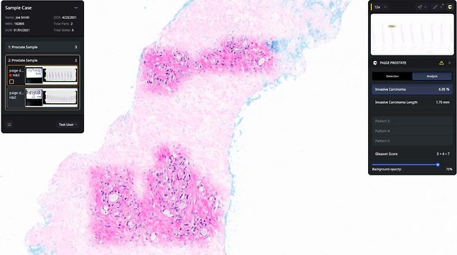 FDA 승인을 받은 'Paige Prostate'. (사진= Paige)