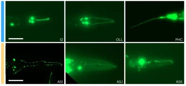 젊은 신경세포(위쪽 파란색 줄)와 노화 신경세포(아래쪽 노란색 줄) / Aging clocks delineate neuron types vulnerable or resilient to neurodegeneration and identify neuroprotective interventions. Nat Aging (2026)