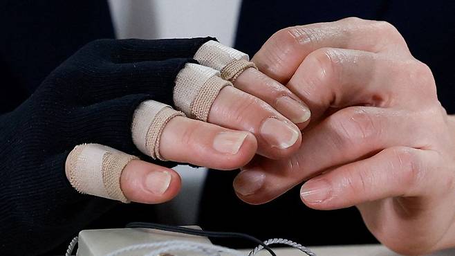 지난 8일 도쿄 자민당 본부에서 인터뷰 중인 다카이치 사나에 일본 총리의 부상당한 손. 다카이치 총리가 X(옛 트위터)에서 밝힌 바에 따르면 유세장에서 많은 사람들과 악수하면서 손을 많이 사용했는데, 열성 지지자와 악수할 때 세게 당겨져 다친 것이라고 한다. 이 과정에서 지병인 류머티스 관절염(만성 관절염)도 악화됐다고 한다. 로이터=연합뉴스