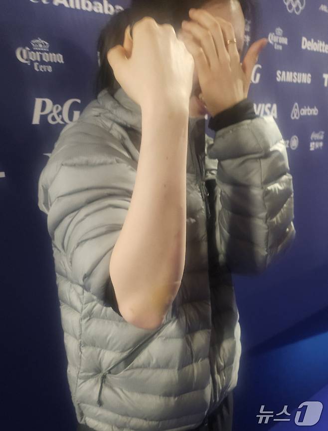 김길리가 11일(한국시간) 이탈리아 밀라노 아이스 스케이팅 아레나에서 훈련을 마친 뒤 취재진에 자신의 상처 부위를 보여주고 있다. ⓒ 권혁준 기자