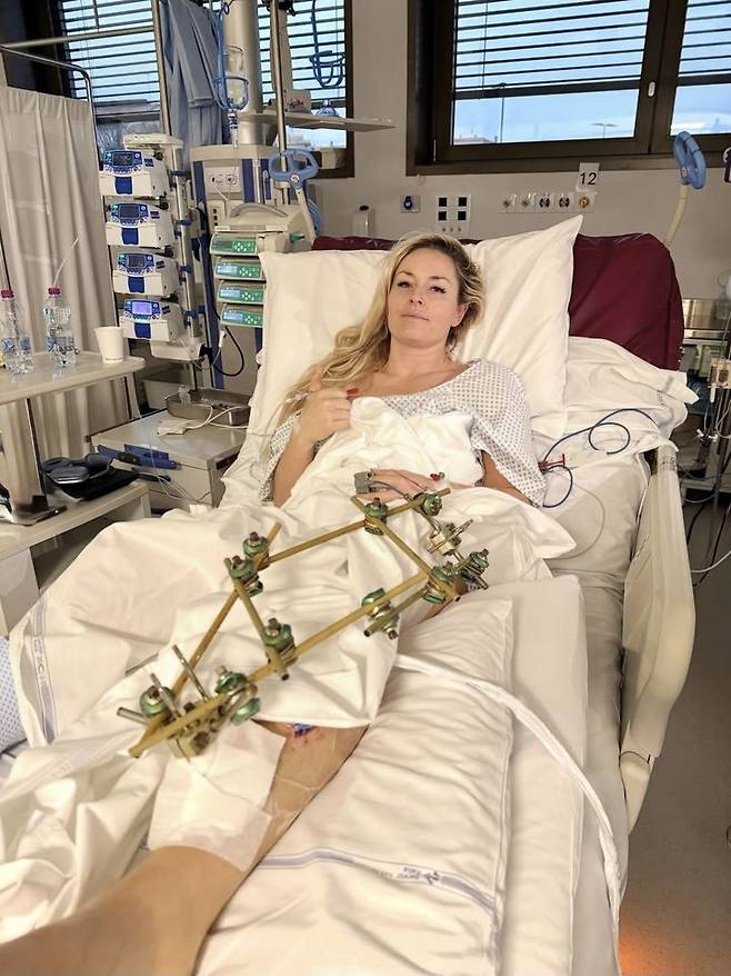 [서울=뉴시스] 지난 8일(한국 시간) 이탈리아 코르티나담페초의 토파네 알파인스키 센터에서 열린 2026 밀라노·코르티나담페초 동계올림픽 알파인 스키 여자 활강 경기 도중 부상을 당한 미국의 스키 여제 린지 본이 12일 자신의 사회관계망서비스(SNS)를 통해 성공적으로 수술을 마쳤다는 소식을 전했다. (사진=린지 본 SNS 캡처) 2026.02.12. *재판매 및 DB 금지