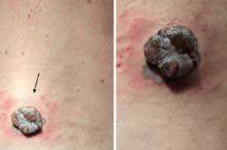 몸에 평소와 다른 결절이 보인다면 암의 신호일 수 있다./사진=큐레우스