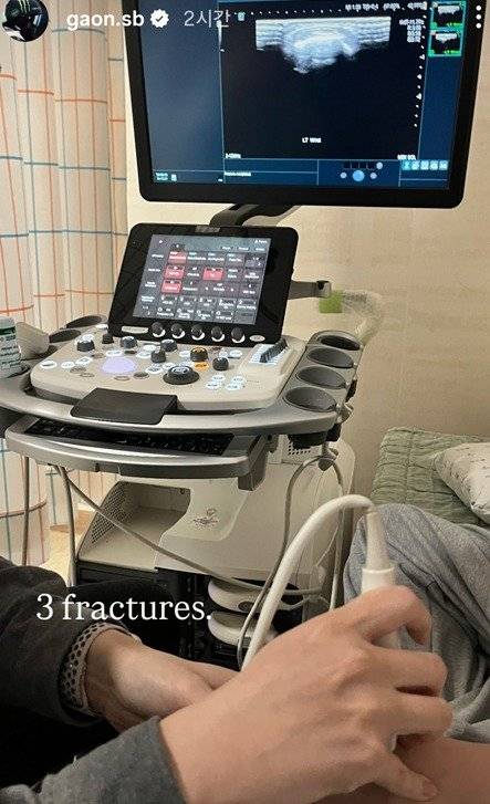 최가온이 SNS를 통해 골절 진단 소식을 전했다.뉴스1