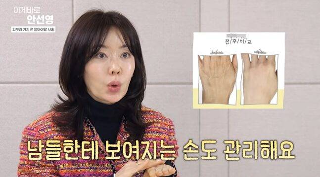 안선영은 얼굴 못지않게 손 관리의 중요성을 강조했다. 사진=유튜브 채널 '이게 바로 안선영' 캡처
