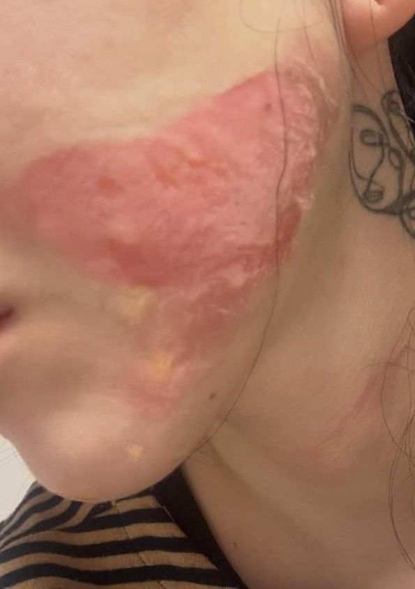 사진 | 권민아 SNS