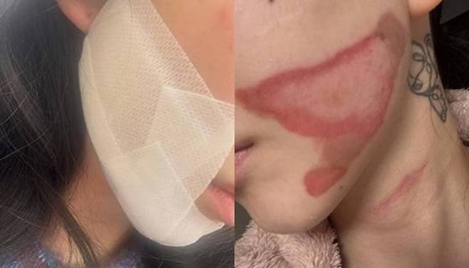 사진 I 권민아 SNS