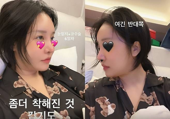 랄랄 소셜미디어