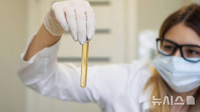 [서울=뉴시스] 27일 의료계에 따르면 만성신장질환은 신장기능이 줄어들거나 단백뇨 같은 손상이 3개월 이상 계속되는 상태를 말한다. 적절한 체중을 유지해 단백뇨를 줄이는 것도 신장 기능을 보호하는 방법 중에 하나이다. (사진= 유토이미지 제공)