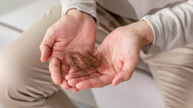 탈모는 호르몬, 유전, 스트레스 등 복합적인 원인으로 발생할 수 있다｜출처: 클립아트코리아