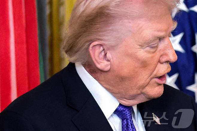 2일(현지시간) 미국 워싱턴 DC 백악관에서 열린 명예훈장 수여식에 참석한 도널드 트럼프 미국 대통령의 목덜미 위로 발진이 드러나 있다. 2026.03.02. ⓒ 로이터=뉴스1