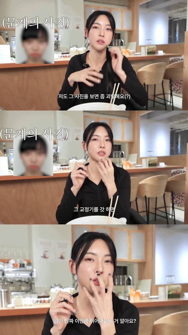 갓 교정기를 한 후의 사진에 대해 설명하는 김민지. 유튜브 채널 '김민지 KIMMINGEE' 영상 캡처