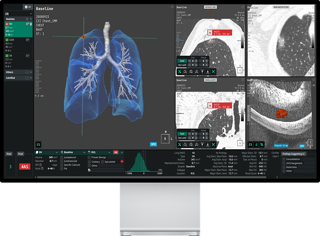 코어라인소프트의 에이뷰 소프트웨어 (자료=코어라인소프트)