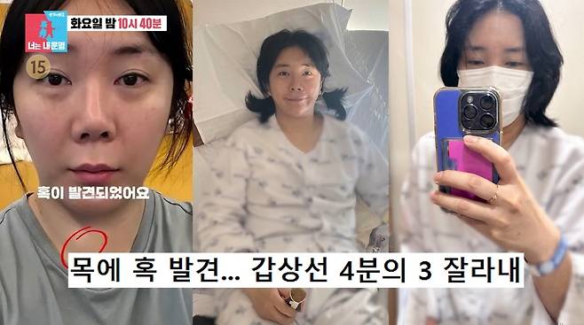 SBS 동상이몽 2 - 너는 내 운명 방송 화면 캡처