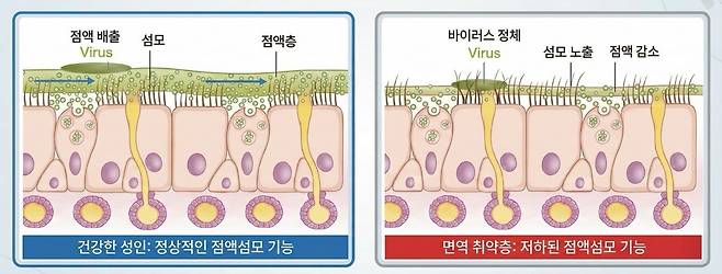 코 점막의 섬모·점액 작용 원리와 면역 상태에 따른 방어력 차이｜출처: 하이닥