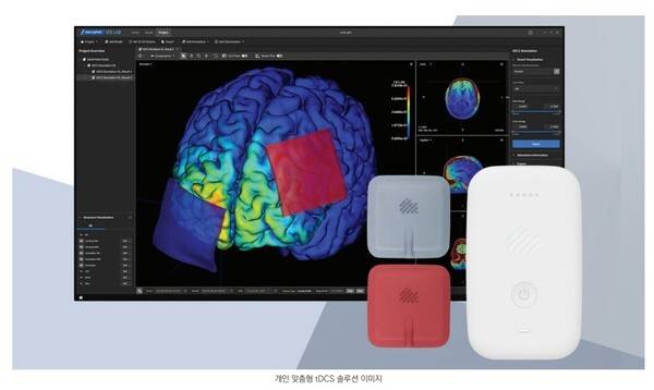 사진제공=뉴로핏