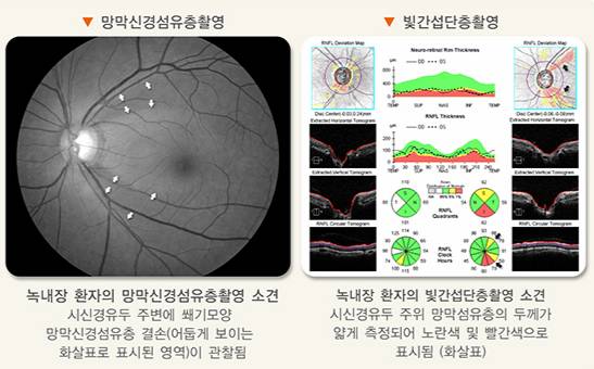 /자료=국가건강정보포털