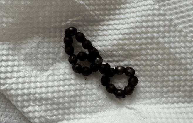 어린이의 뱃속에서 꺼낸 자석들. 사진=큐레우스(Cureus)