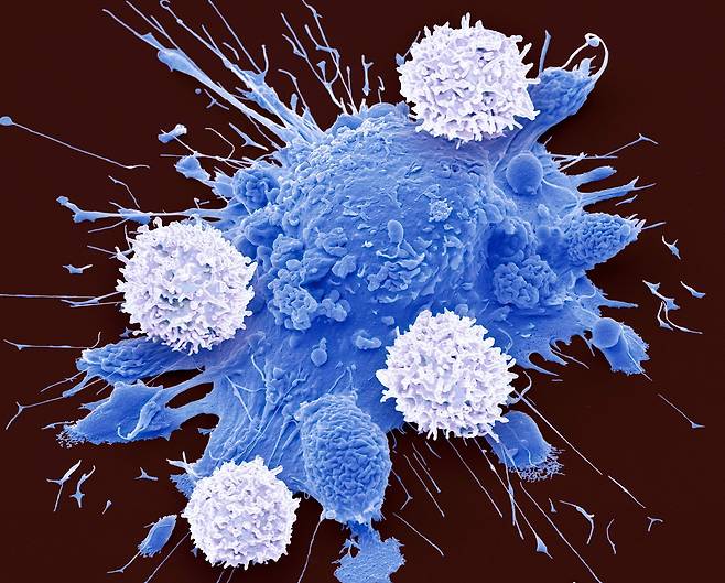 T세포(흰색)가 암세포(파란색)를 공격하는 모습의 주사 전자현미경 사진./Steve Gschmeissner/Science Photo Library