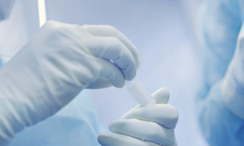 연구원 검체 검사. (사진=게티이미지뱅크)