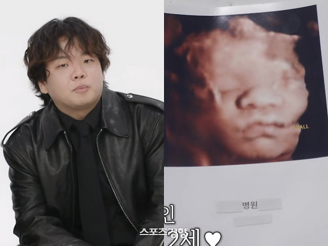 SBS 예능 ‘아니 근데 진짜!’ 캡처.