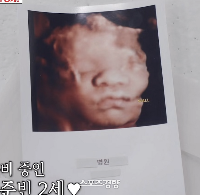 SBS 예능 ‘아니 근데 진짜!’