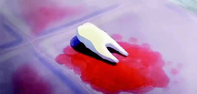 애니메이션 ‘티스’에서 주인공은 빠진 이에 대해 과도한 집착을 보인다. Alter 제공