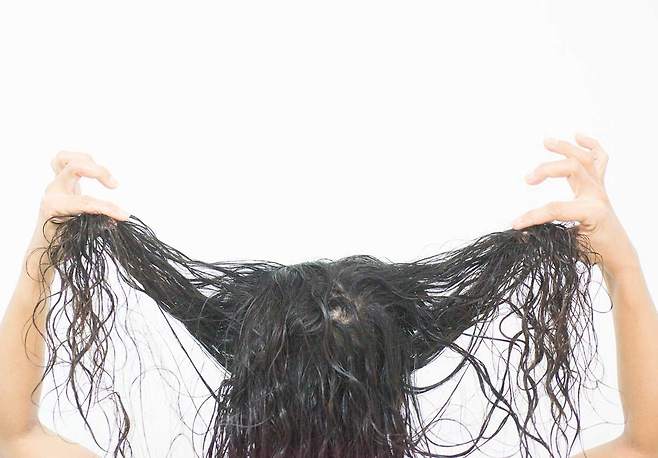 모발 상태에 따라 탈모 여부를 추정하는 경우는 많지만, 그 외 다른 질환을 함께 의심하는 경우는 드물다./사진=게티이미지뱅크