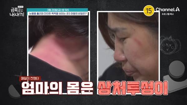 ⓒ'요즘 육아 - 금쪽같은 내 새끼' 예고 영상 캡처