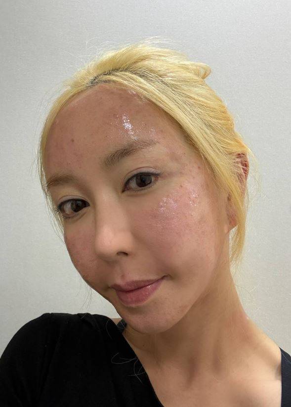 ▲ 슈가 게재한 첫 번째 사진. 출처| 슈 인스타그램