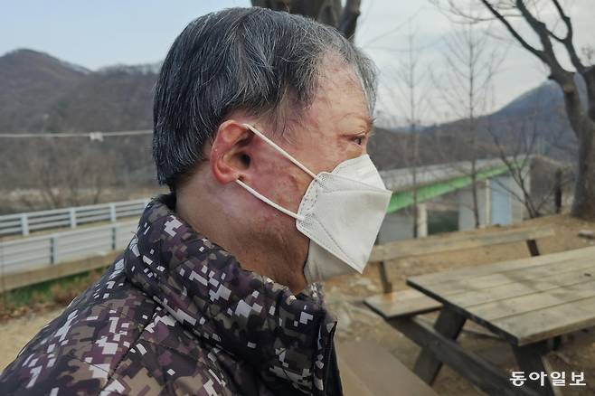11일 오후 경북 안동시 임동면 박곡리에서 만난 김수태 씨의 얼굴에는 지난해 3월 산불로 인해 생긴 화상의 흔적이 가득했다. 김 씨는 당시 화재로 아내 고 김수정 씨를 잃었다. 안동=정동진 기자 haedoji@donga.com