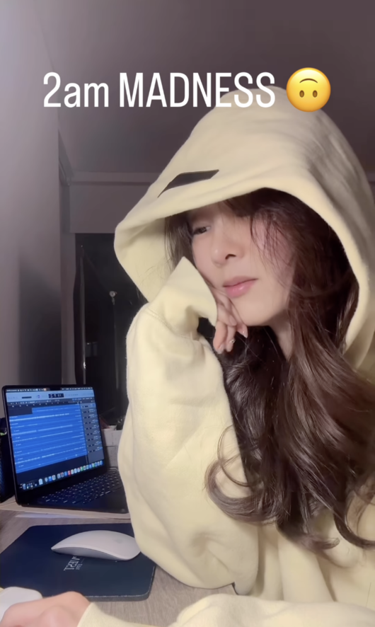 가수 지나. 사진 | 지나 SNS