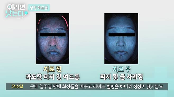 /조선일보 의학·건강 유튜브 '이러면 낫는다'